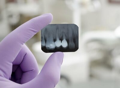 Dental Equipment