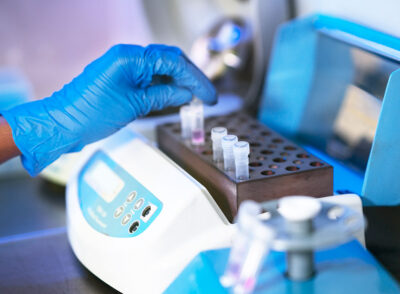 Hematology Equipment